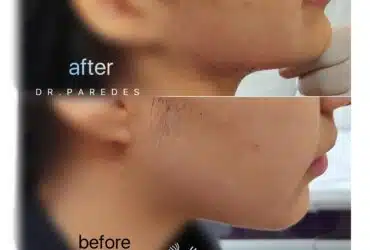 قبل و بعد از عمل زیبایی دکتر پاردس